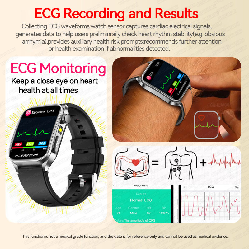 นาฬิกาสมาร์ทวอทช์รุ่นใหม่ปี 20 - Android Smartwatch Accessories บทวิจารณ์และราคา